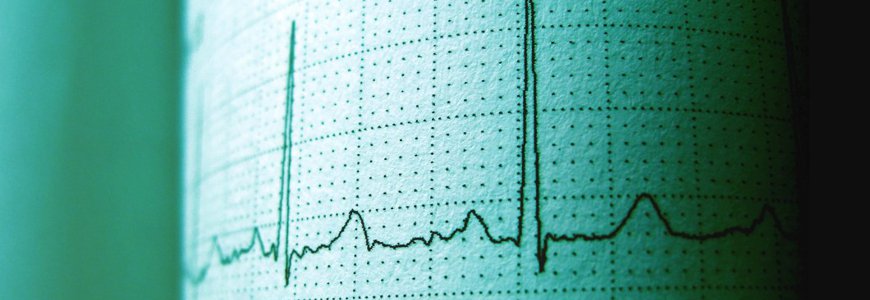 Electrocardiograma Algarrobo